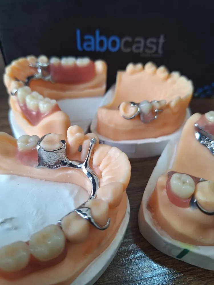 Several partial dentures on working models