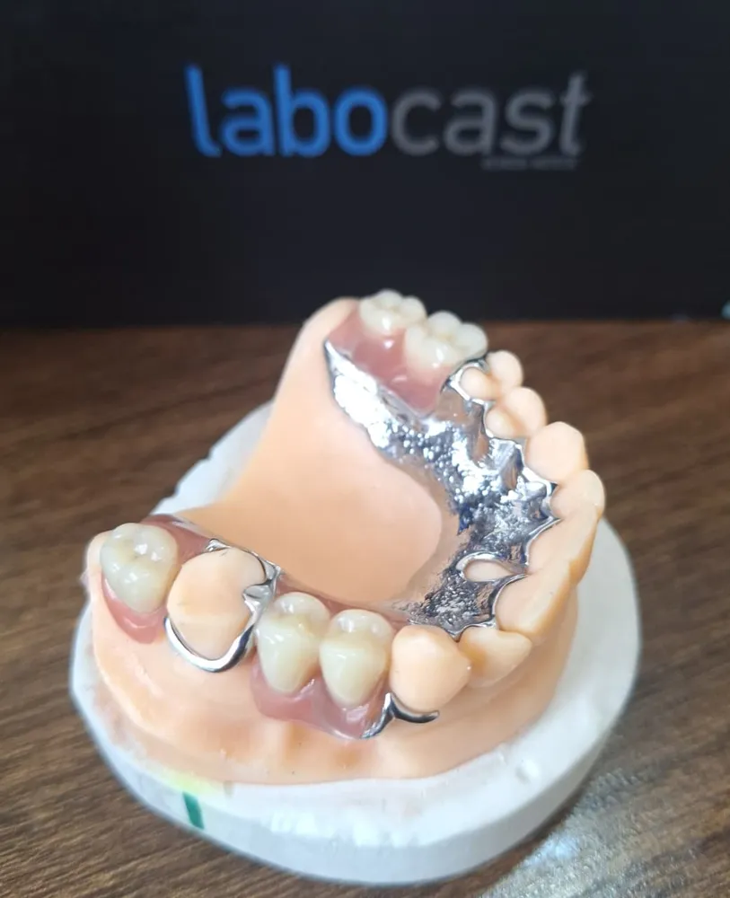Partial denture in pink acrylic