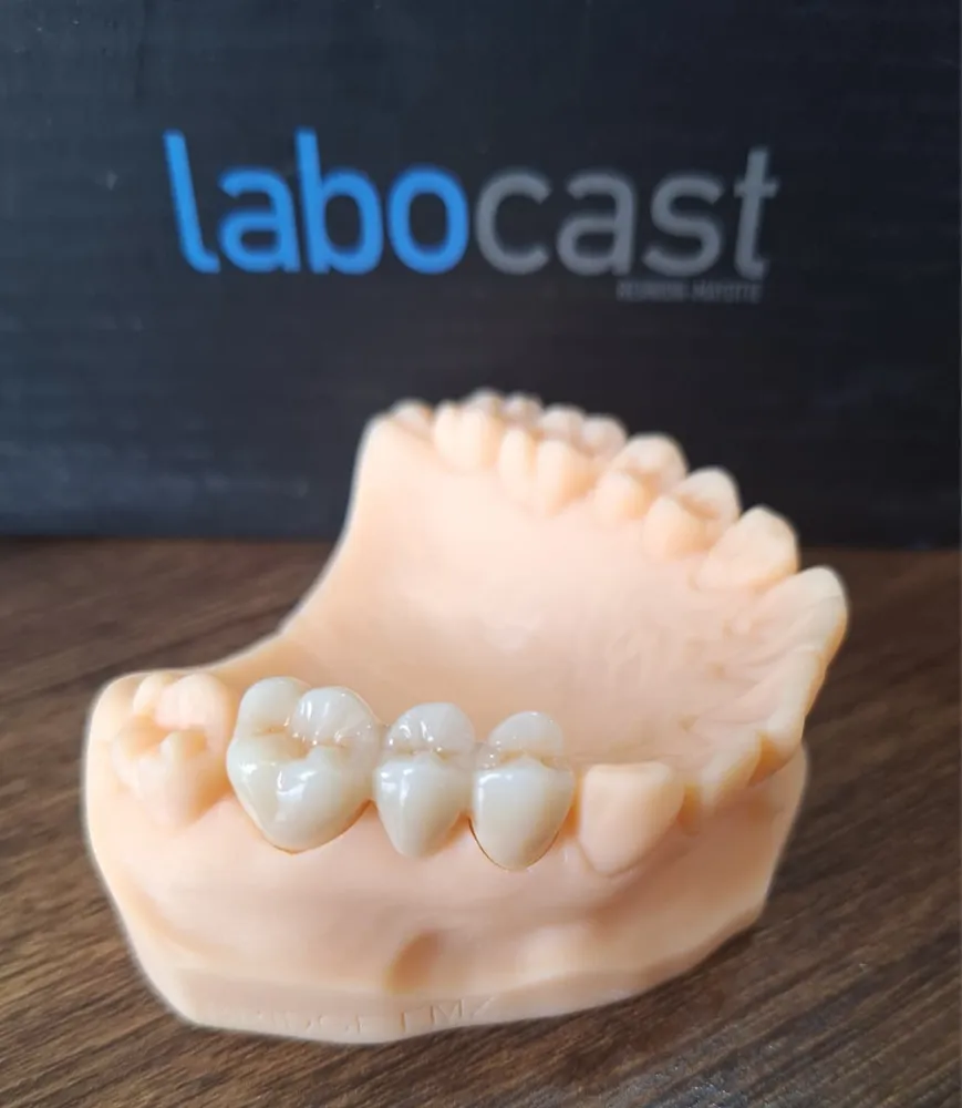 Lower denture with framework