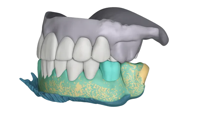 3D digital mock-up of a smile